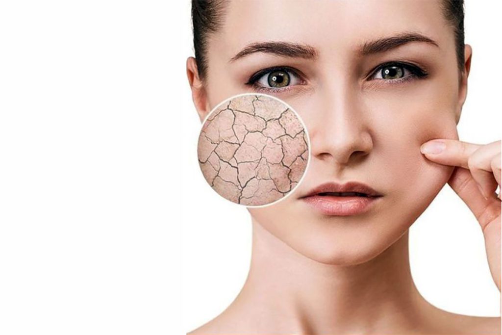 روتین پوست خشک تراست